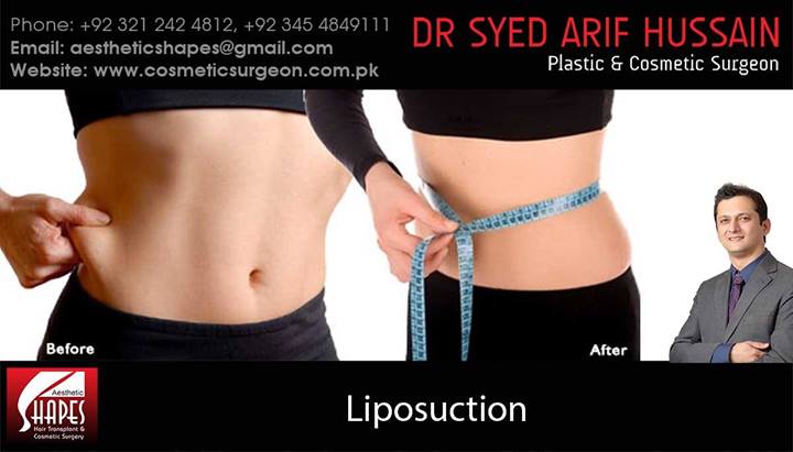 Liposuction Pakistan